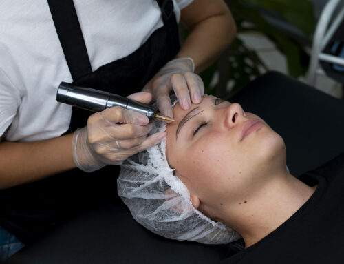 آیا مو های بخش های دیگر بجز پشت سر را می توان پیوند زد؟